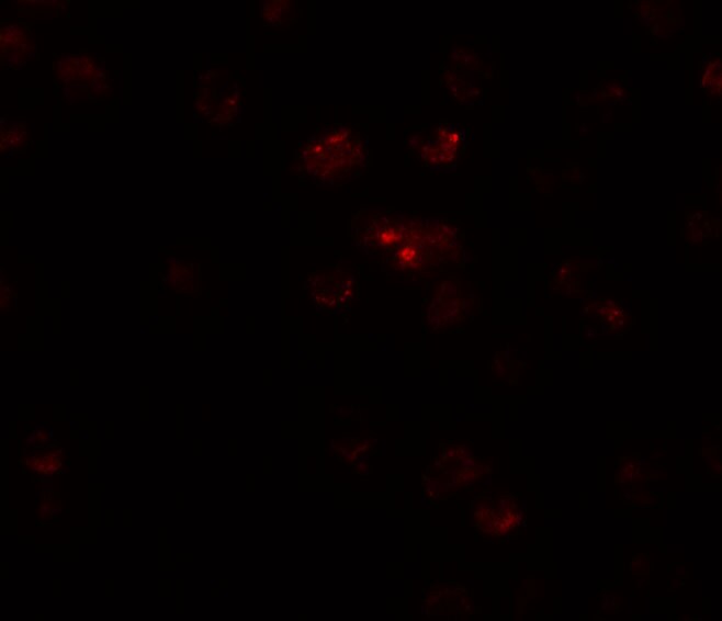 TSHZ2 Antibody - BSA Free