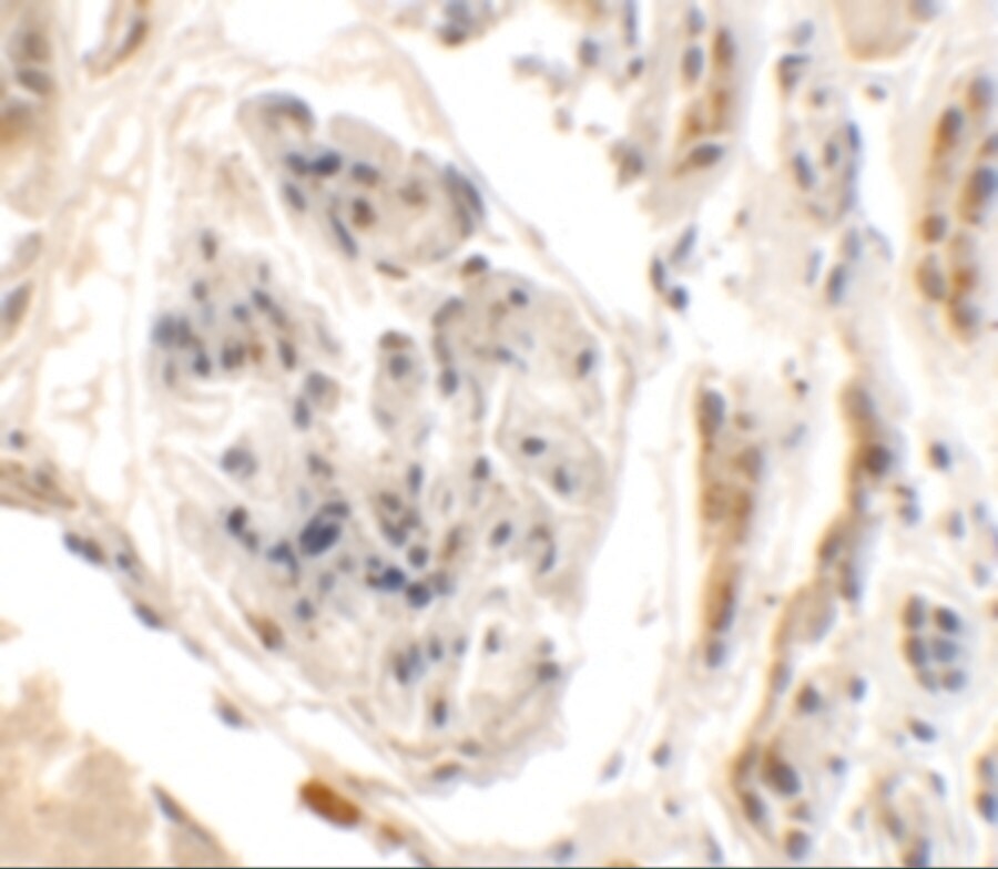 UHRF1BP1L Antibody - BSA Free