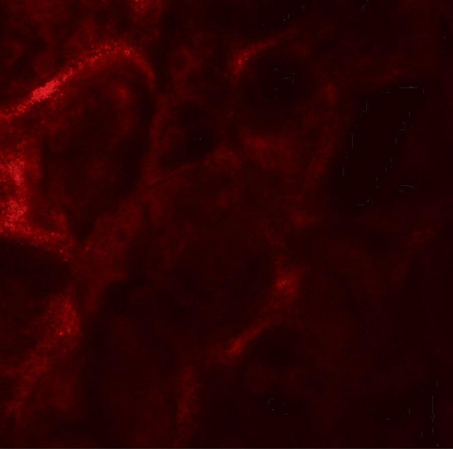 ZFYVE21 Antibody - BSA Free