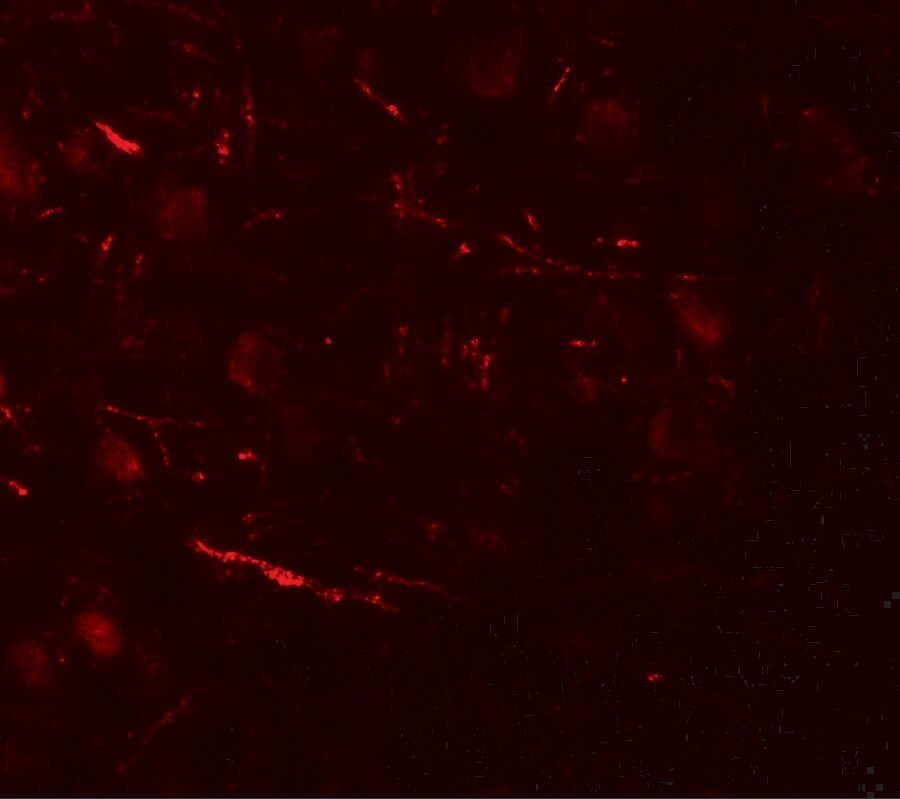 VPS13B Antibody - BSA Free