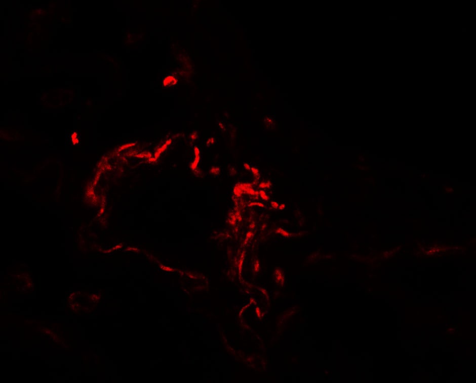 ACSL1 Antibody - BSA Free