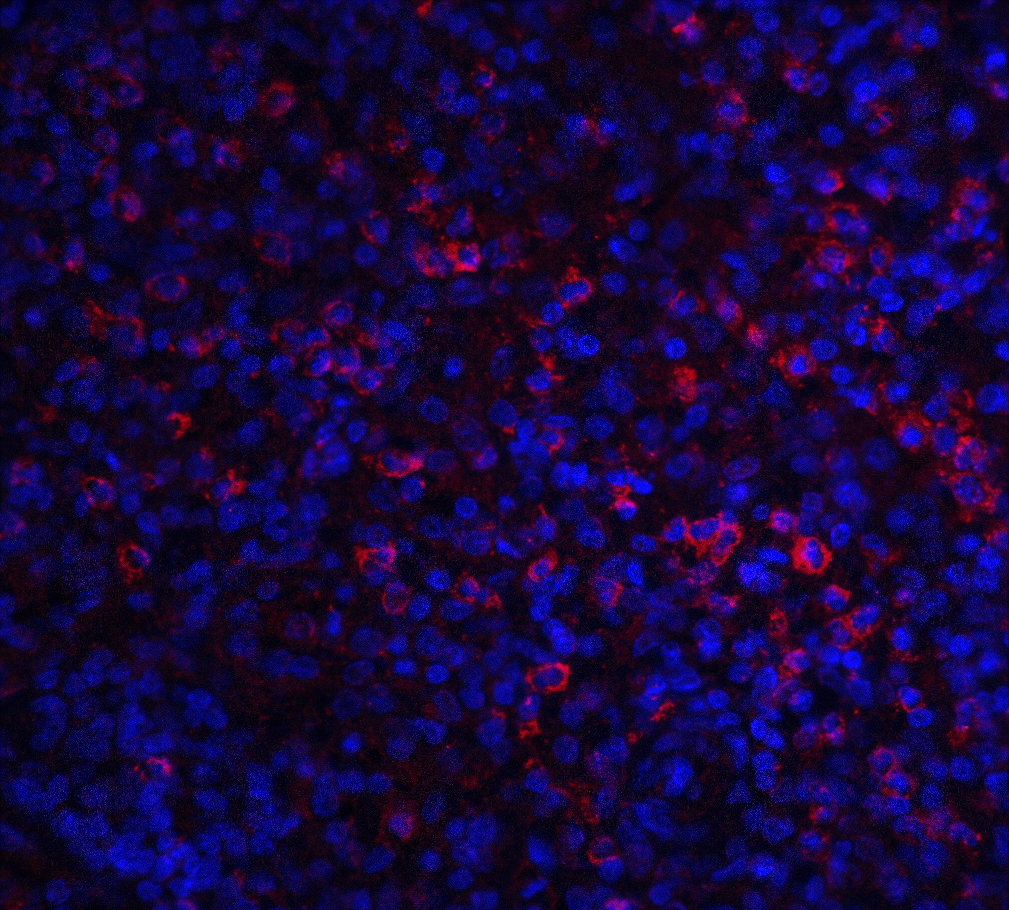 ABCA7 Antibody - BSA Free