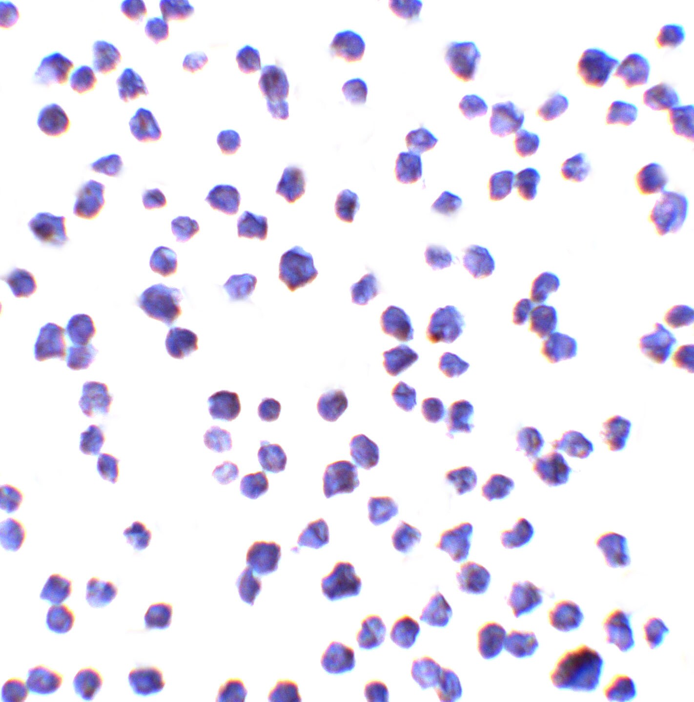 C9orf72 Antibody - BSA Free