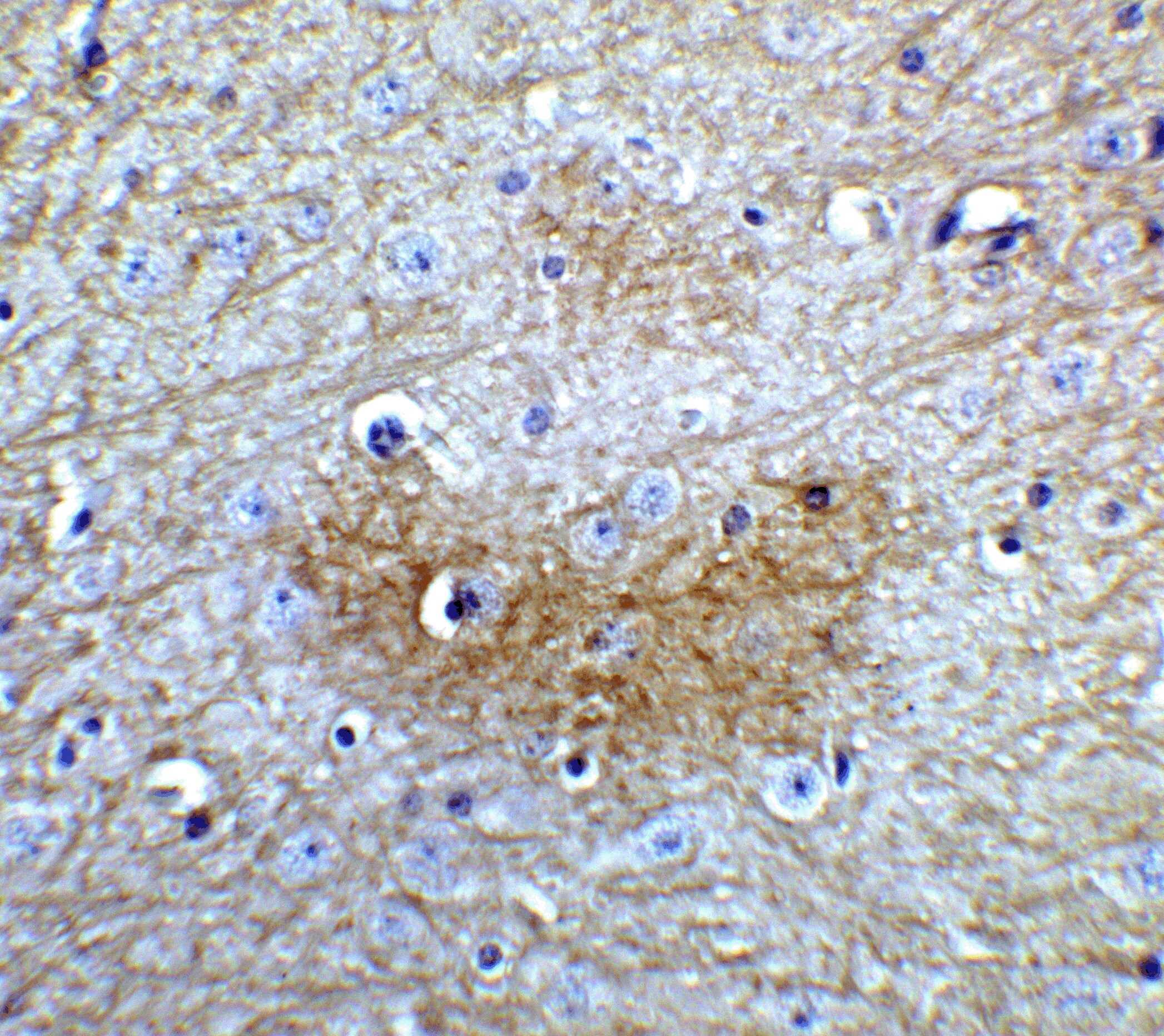 GLS2 Antibody - BSA Free