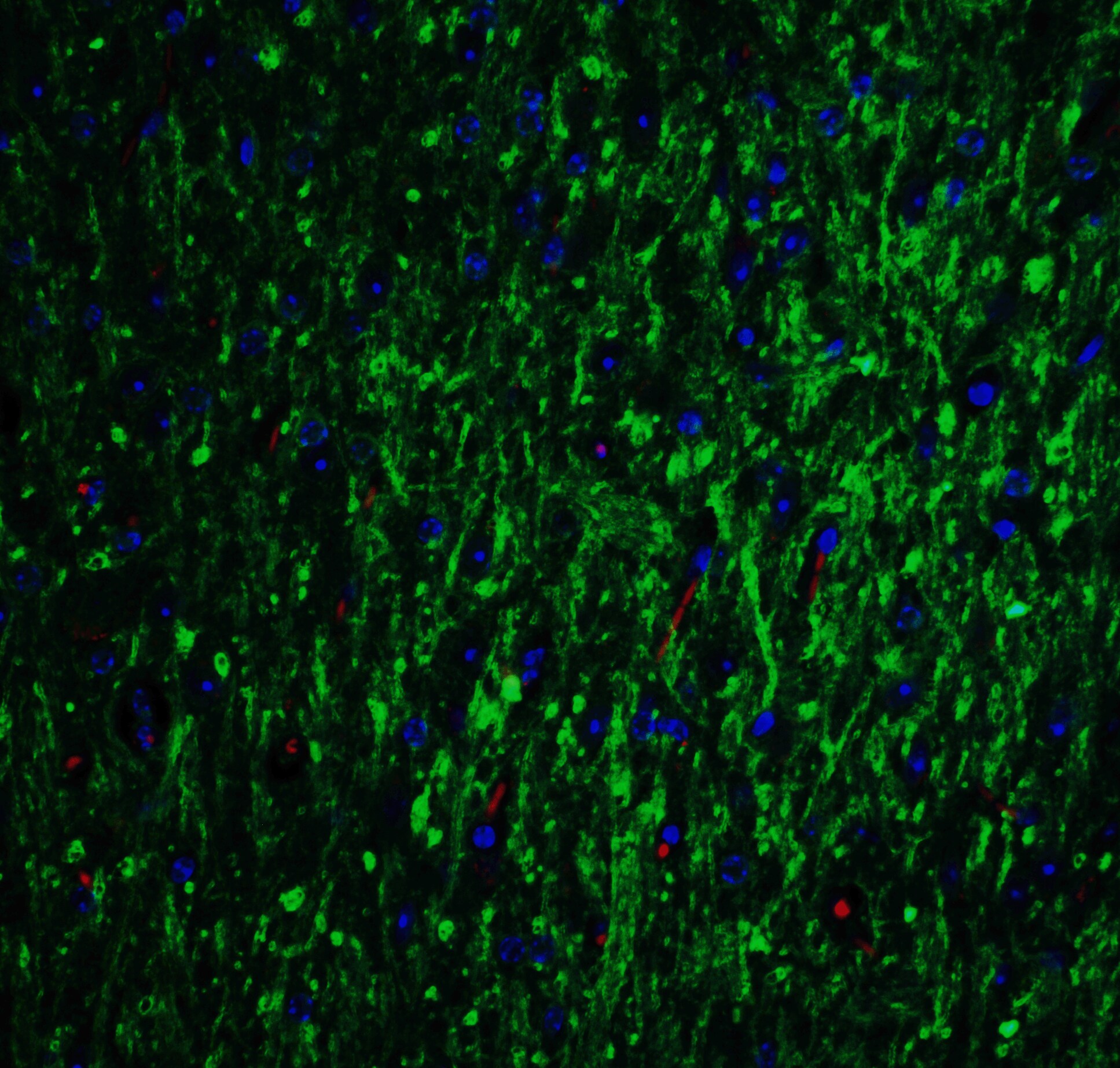 GLS2 Antibody - BSA Free