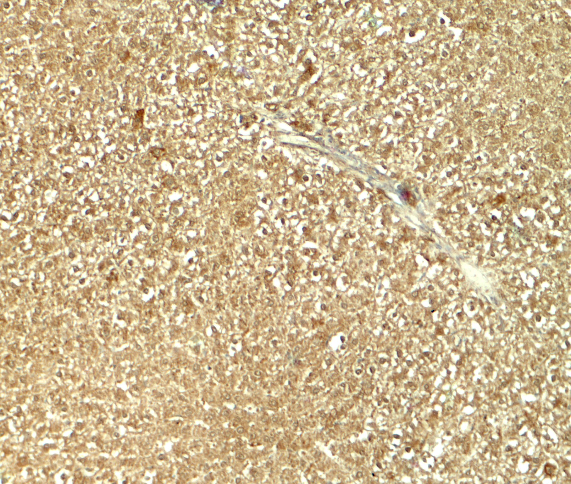 GLS2 Antibody - BSA Free