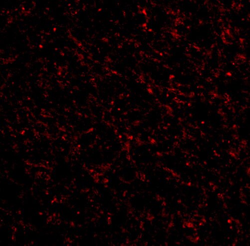 NK3R/TACR3/Neurokinin B Receptor Antibody - BSA Free