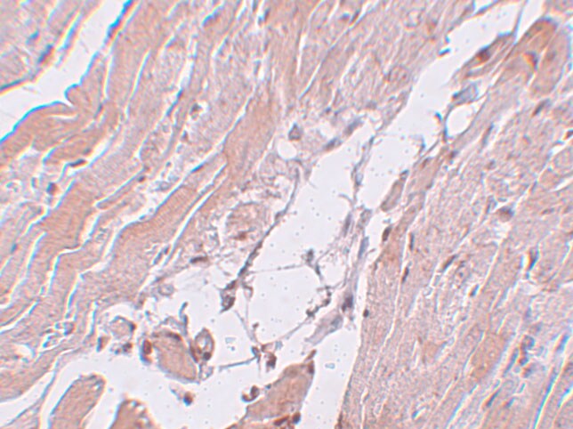 CCDC47 Antibody - BSA Free