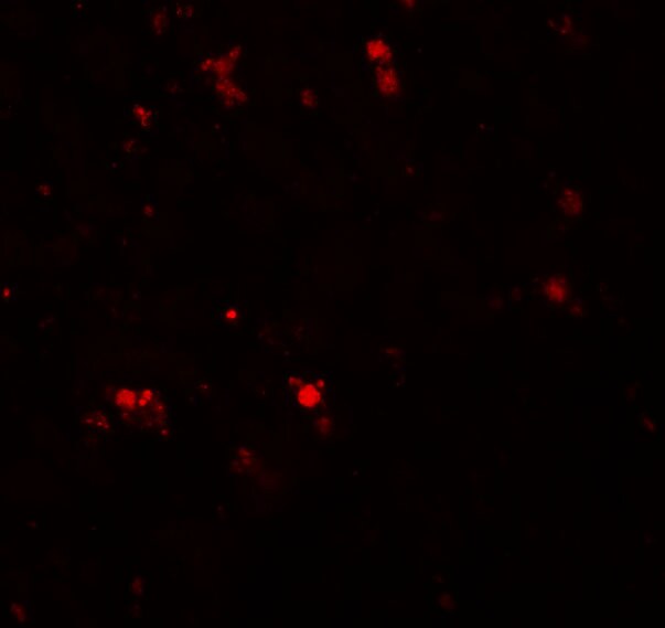 ELOVL7 Antibody - BSA Free
