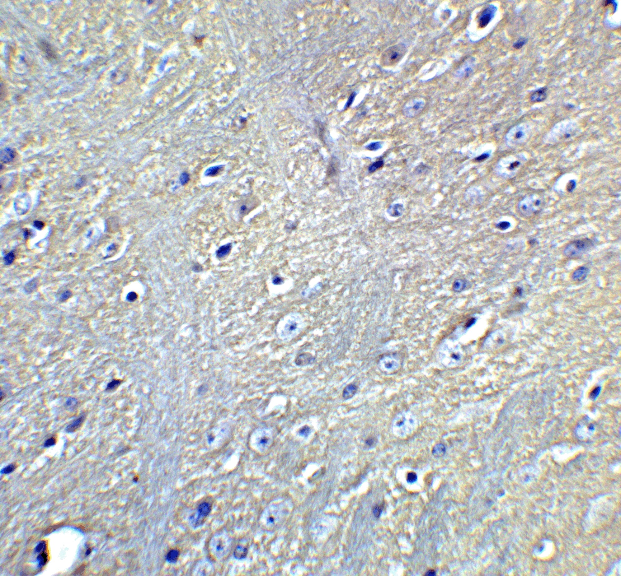 GATE-16/GABARAPL2 Antibody - BSA Free