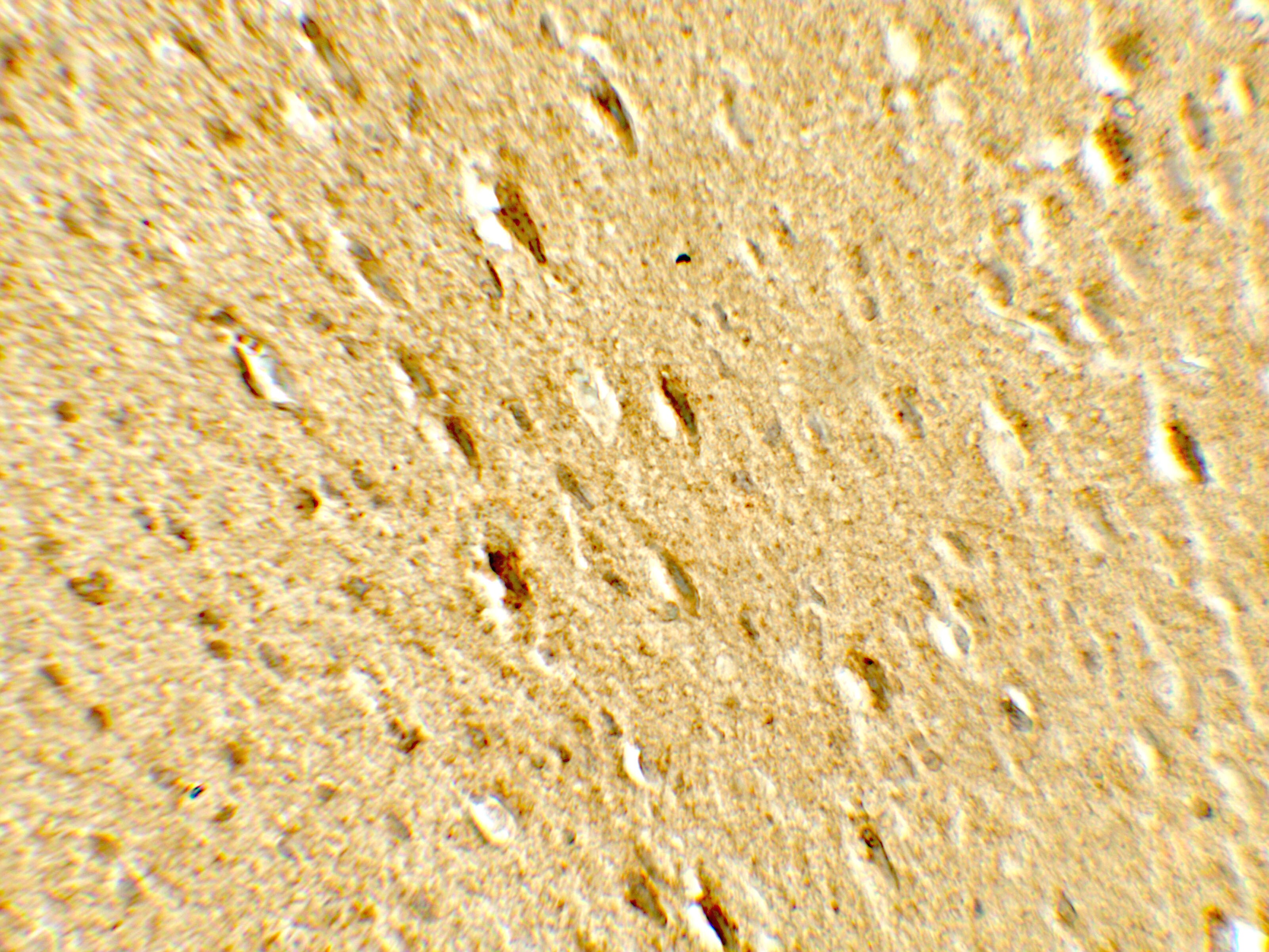 GATE-16/GABARAPL2 Antibody - BSA Free