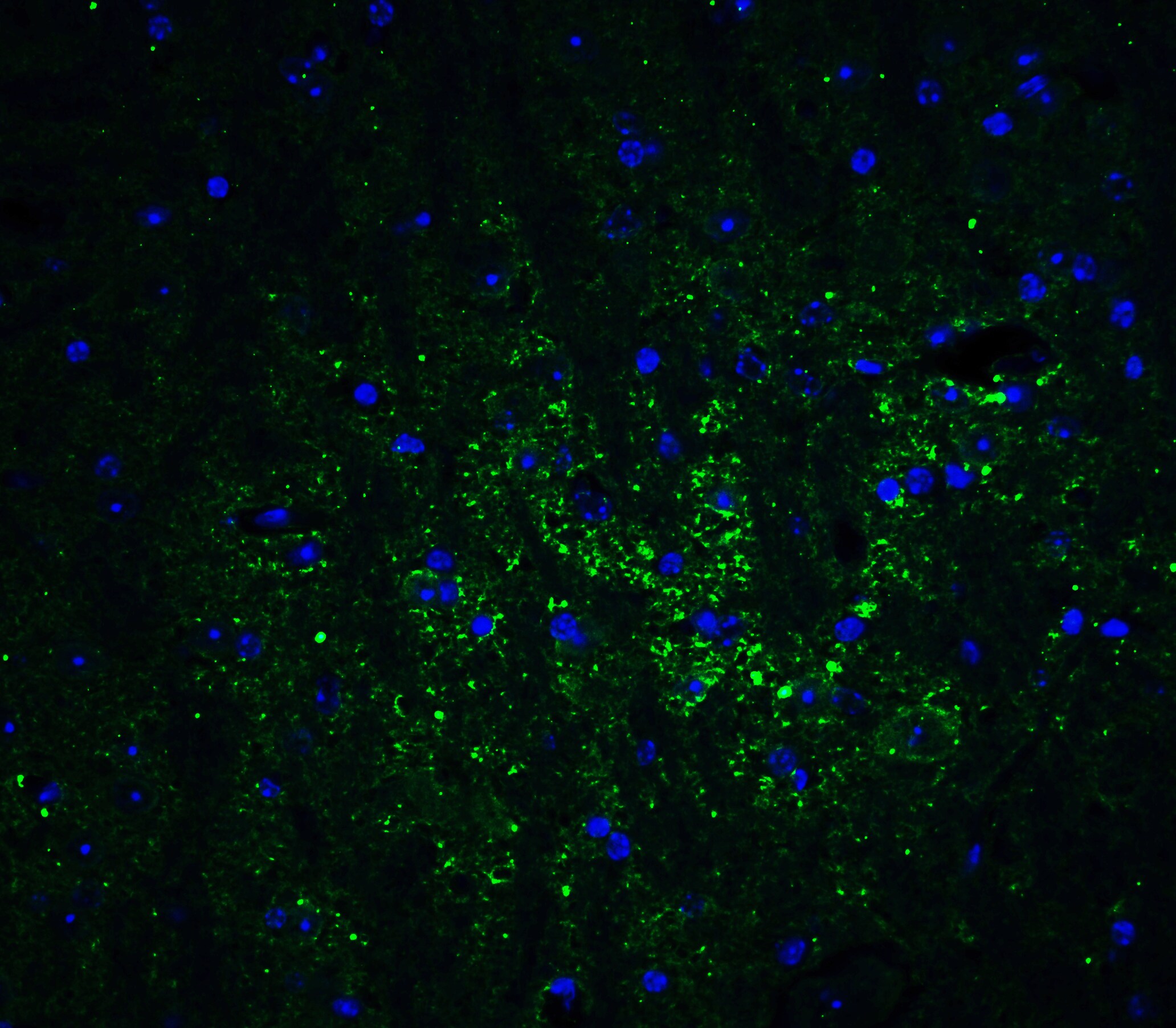 GATE-16/GABARAPL2 Antibody - BSA Free