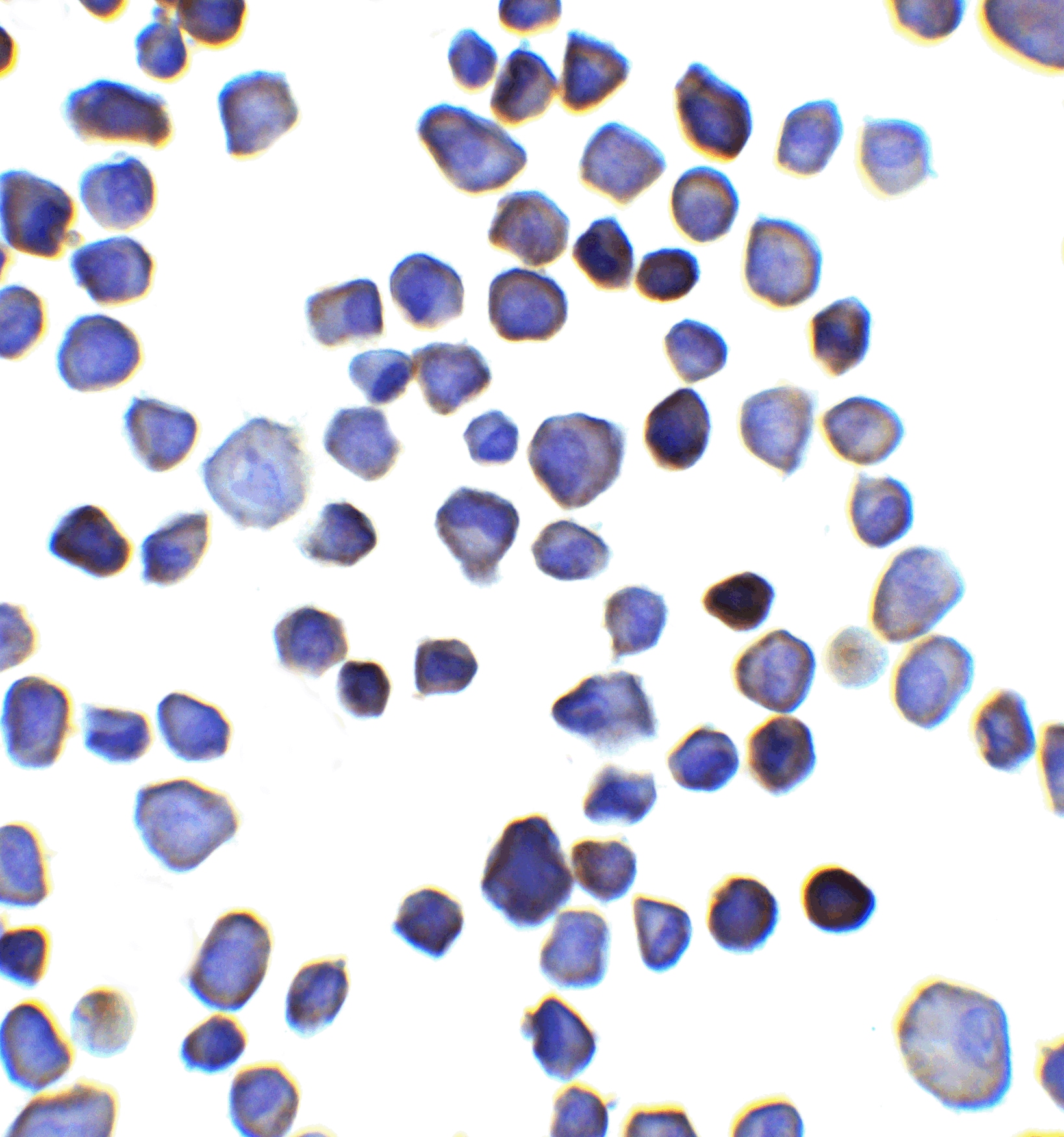 INPP4B Antibody - BSA Free