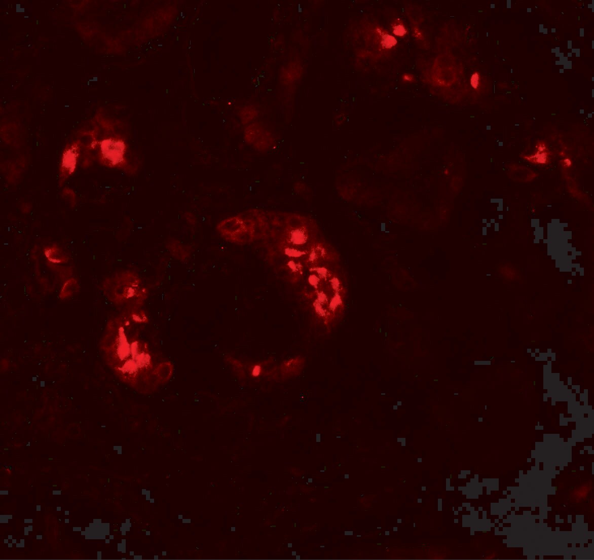 KANK2 Antibody - BSA Free