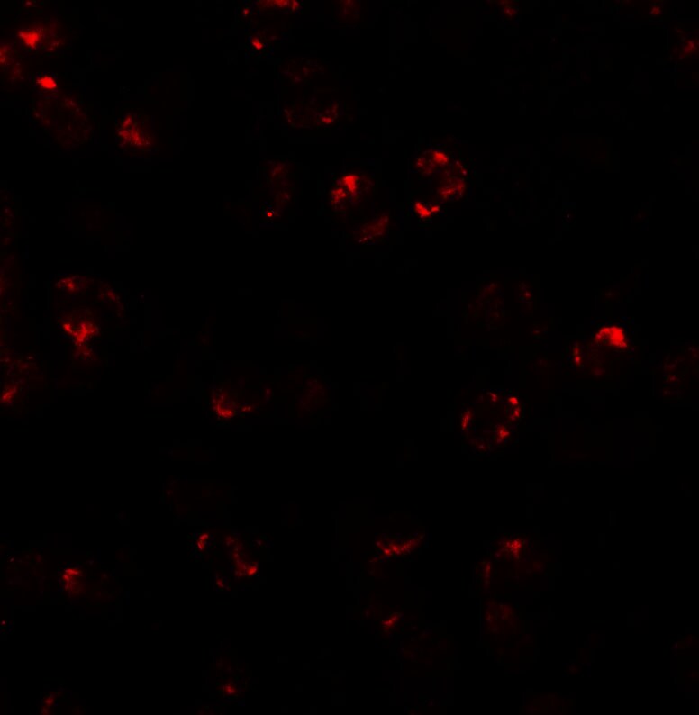 LEMD2 Antibody - BSA Free