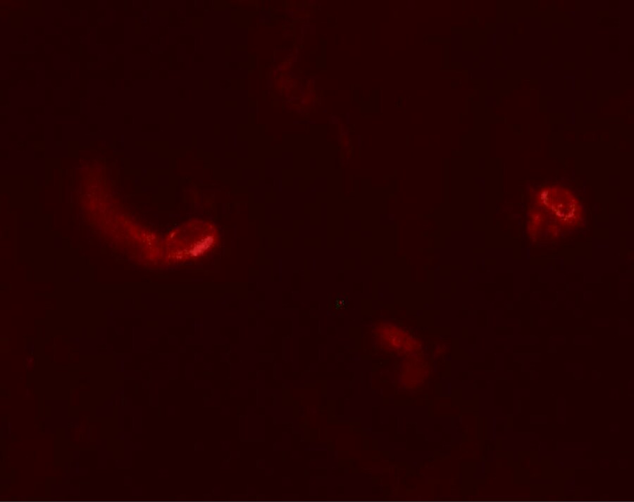 LEMD3 Antibody - BSA Free