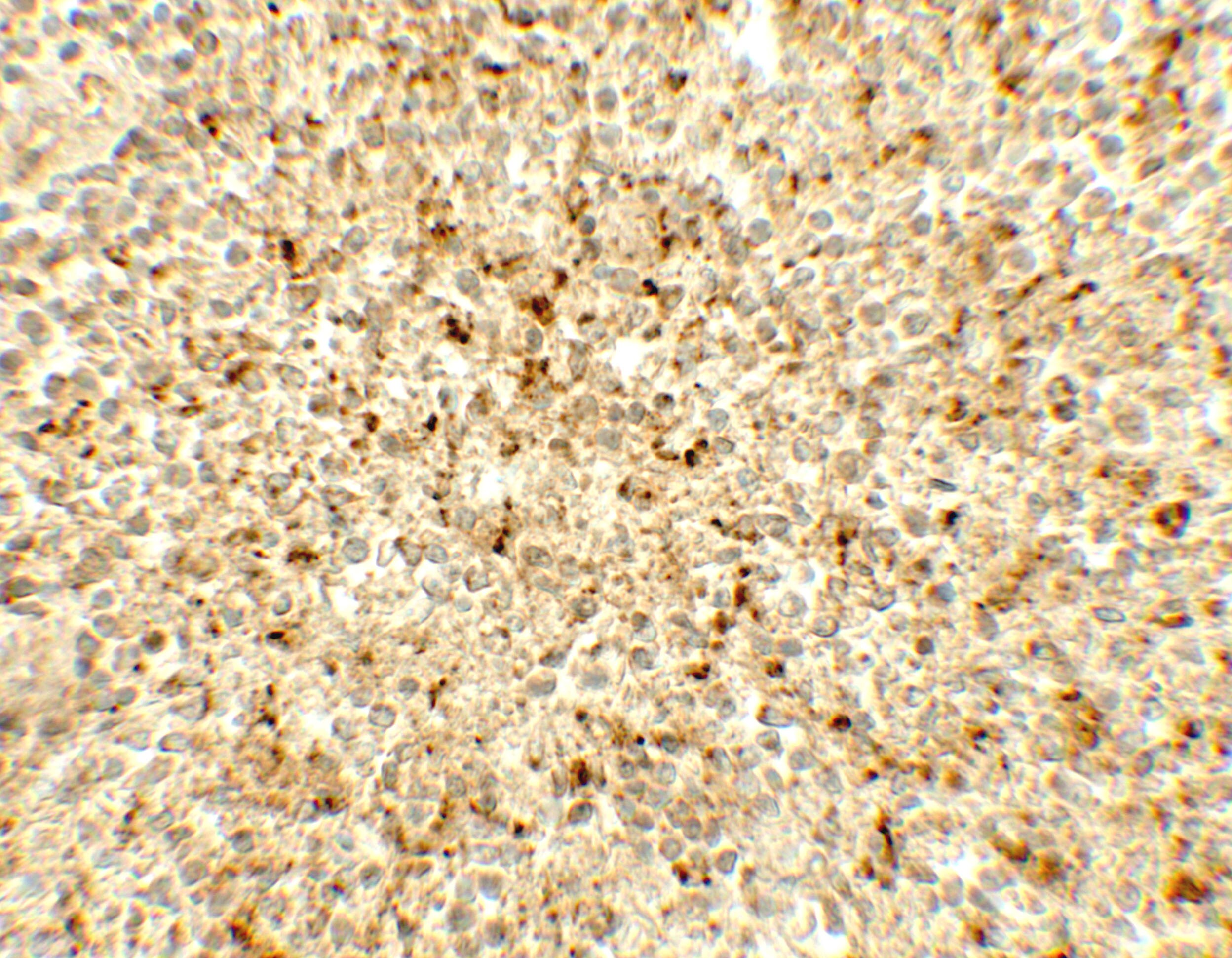ME2 Antibody - BSA Free