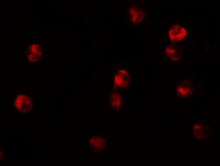 Lysine (K)-specific Demethylase 6B/KDM6B/JMJD3 Antibody - BSA Free