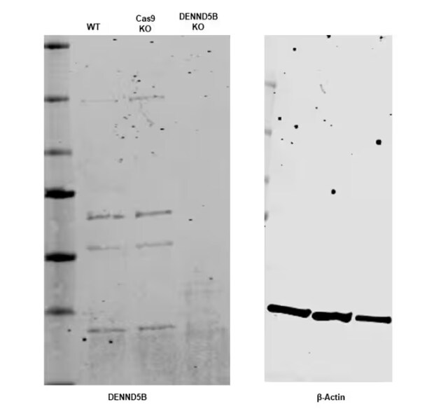 DENND5B Antibody