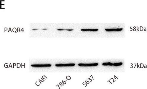 PAQR4 Antibody - BSA Free