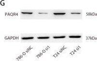 PAQR4 Antibody - BSA Free