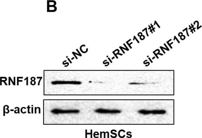 RNF187 Antibody - BSA Free