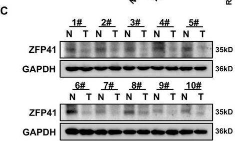 ZFP41 Antibody - BSA Free