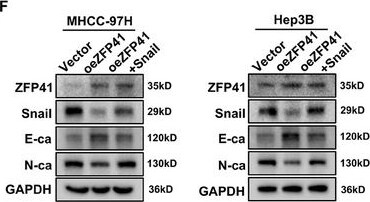 ZFP41 Antibody - BSA Free