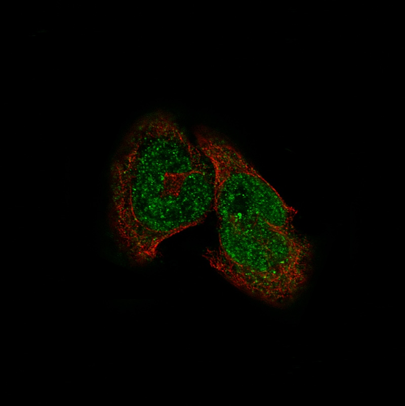 HDAC5 Antibody (CL8121) - BSA Free Immunocytochemistry/ Immunofluorescence: HDAC5 Antibody (CL8121) - BSA Free[NBP2-88913]