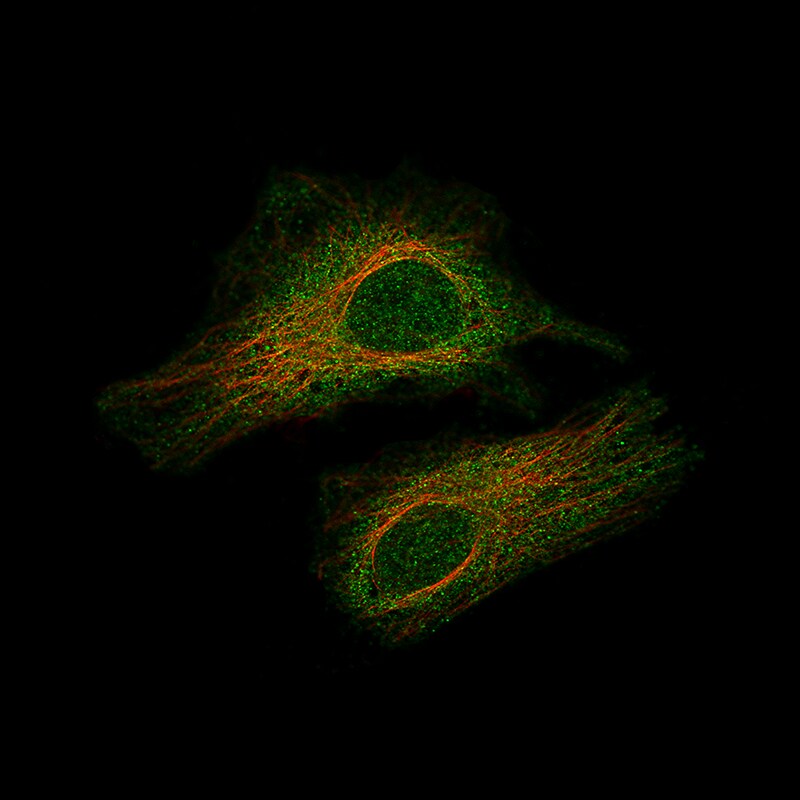 Smad2 Antibody (CL8472) - BSA Free Immunocytochemistry/ Immunofluorescence: Smad2 Antibody (CL8472) [NBP2-88916]