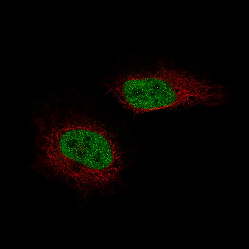 SF-1/NR5A1/Steroidogenic Factor 1 Antibody (CL9101) - BSA Free Immunocytochemistry/ Immunofluorescence: SF-1/NR5A1/Steroidogenic Factor 1 Antibody (CL9101) [NBP2-88921]