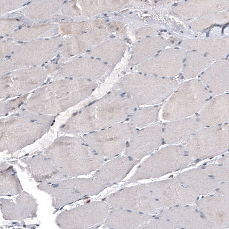 IL-4I1 Antibody (CL9071) - BSA Free Immunohistochemistry-Paraffin: IL-4I1 Antibody (CL9071) [NBP2-88929]