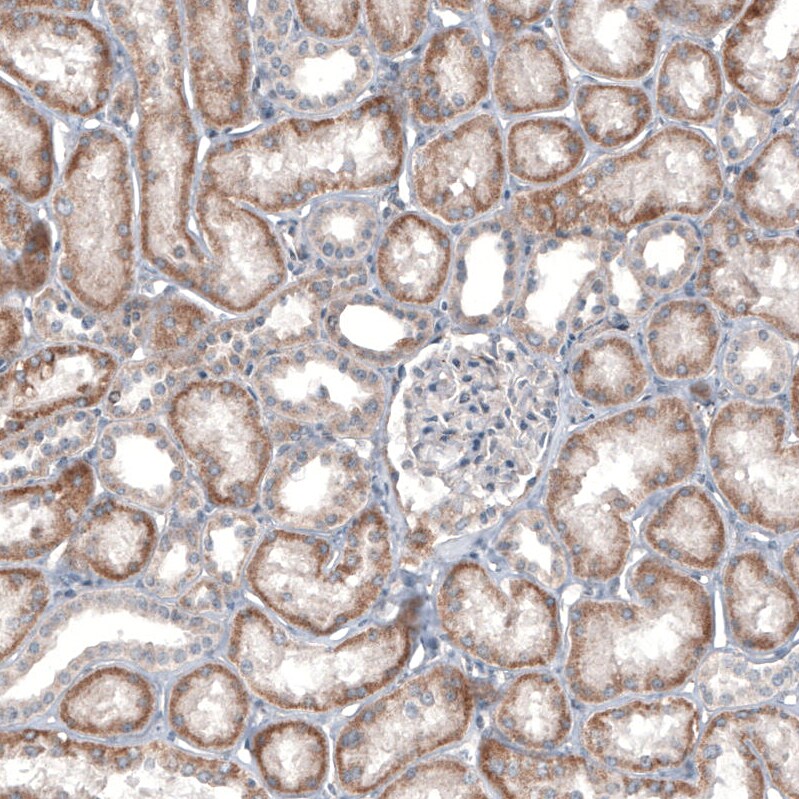 IL-4I1 Antibody (CL9071) - BSA Free Immunohistochemistry-Paraffin: IL-4I1 Antibody (CL9071) [NBP2-88929]