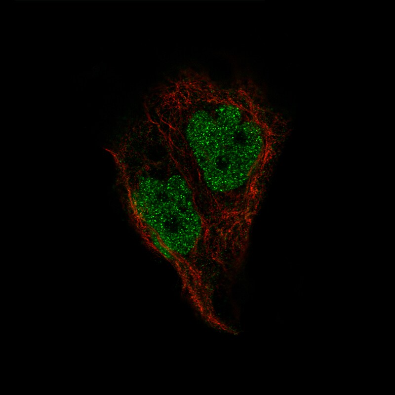 Pax2 Antibody (CL9469) - BSA Free Immunocytochemistry/ Immunofluorescence: Pax2 Antibody (CL9469) [NBP3-52485]