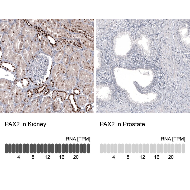 Pax2 Antibody (CL9469) - BSA Free Immunohistochemistry: Pax2 Antibody (CL9469) [NBP3-52485]