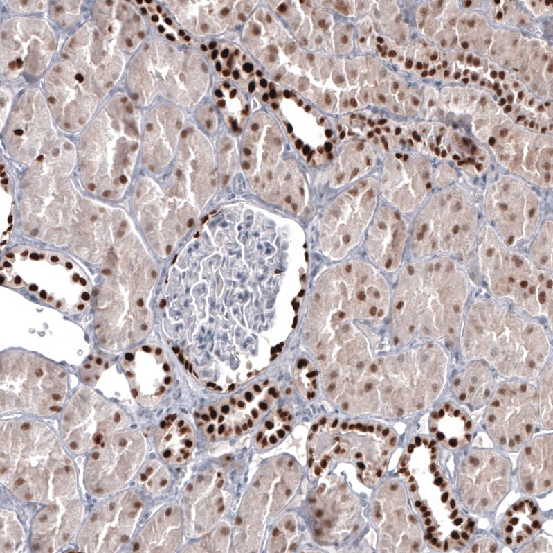 Pax2 Antibody (CL9469) - BSA Free Immunohistochemistry: Pax2 Antibody (CL9469) [NBP3-52485]