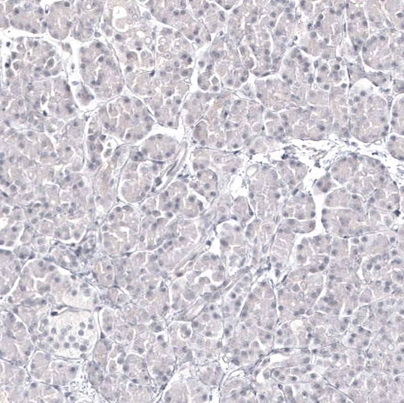Pax2 Antibody (CL9469) - BSA Free Immunohistochemistry: Pax2 Antibody (CL9469) [NBP3-52485]