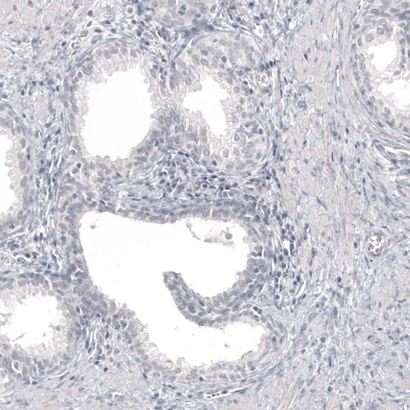 Pax2 Antibody (CL9469) - BSA Free Immunohistochemistry: Pax2 Antibody (CL9469) [NBP3-52485]