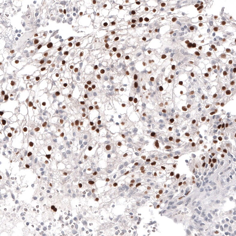 Pax2 Antibody (CL9469) - BSA Free Immunohistochemistry: Pax2 Antibody (CL9469) [NBP3-52485]