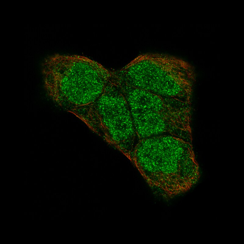 PI 3-Kinase p110 beta/PIK3CB Antibody (CL9518) - BSA Free Immunocytochemistry/ Immunofluorescence: PI 3-Kinase p110 beta/PIK3CB Antibody (CL9518) [NBP2-88937]