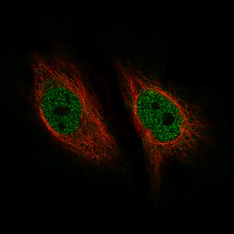 ZNF10 Antibody (CL9747) - BSA Free Immunocytochemistry/ Immunofluorescence: ZNF10 Antibody (CL9747) [NBP2-88940]