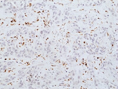 Myeloperoxidase/MPO Antibody (RM407)