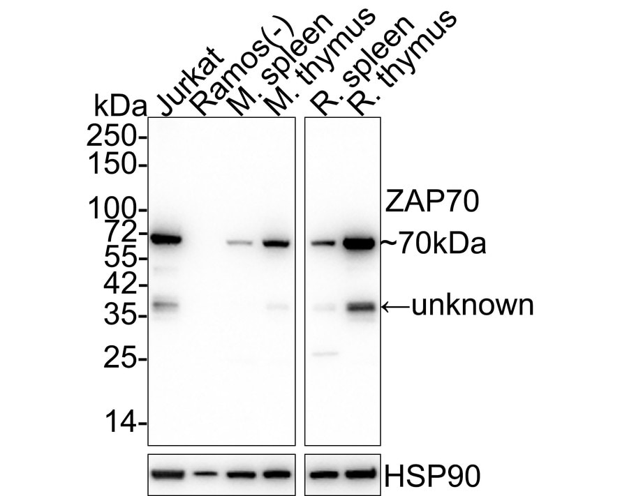 ZAP70 Antibody (A1B5) Western Blot: ZAP70 Antibody (A1B5) [NBP2-89121]