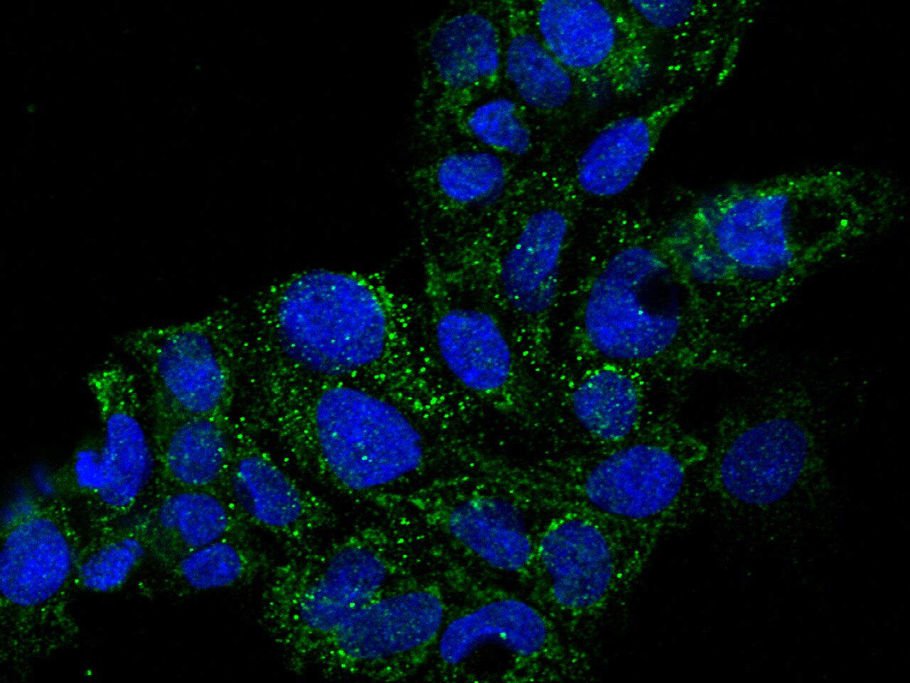 GDF-3 Antibody (010) - Azide and BSA Free