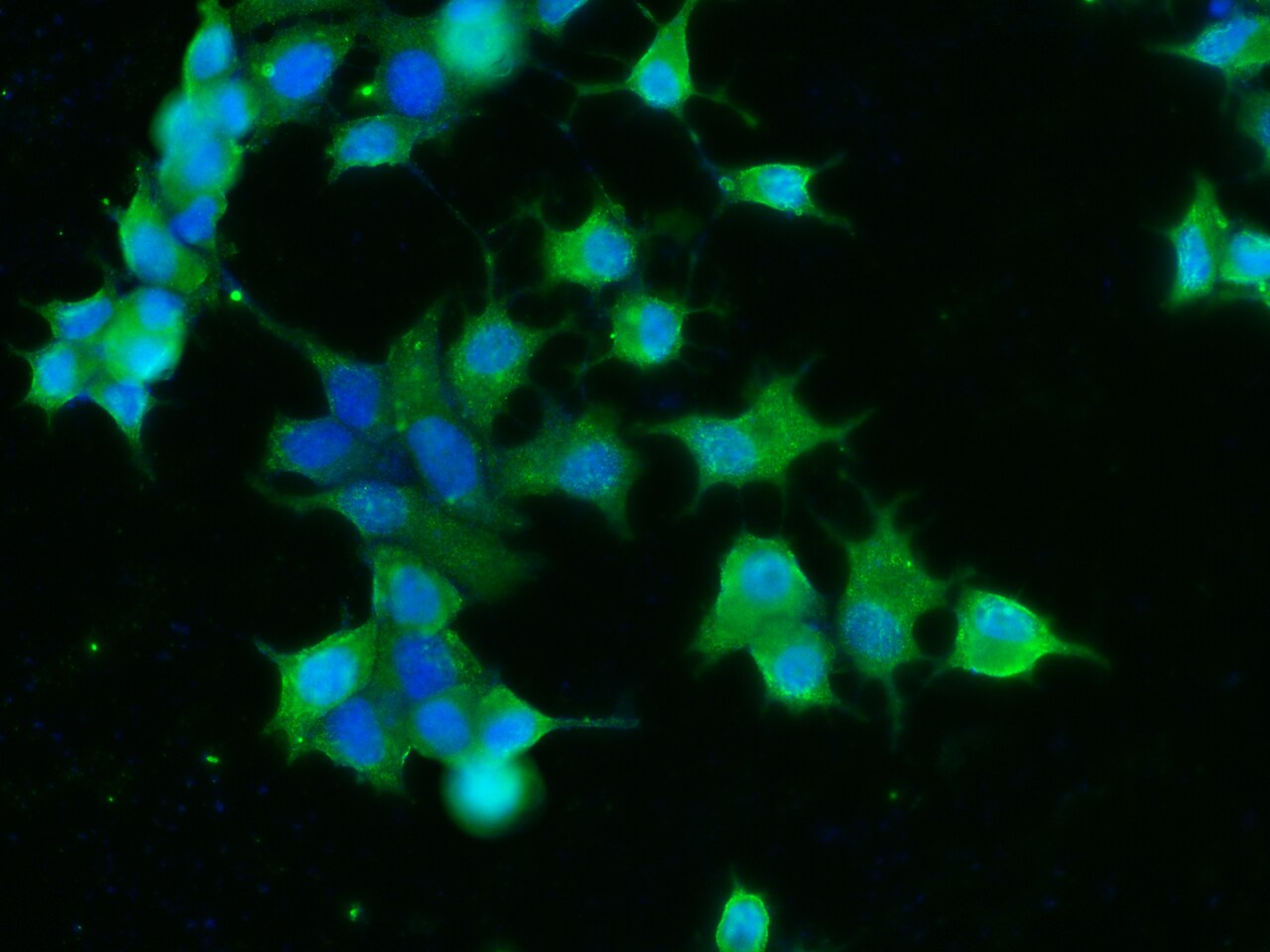 Carnosine Dipeptidase 1/CNDP1 Antibody (001) - Azide and BSA Free