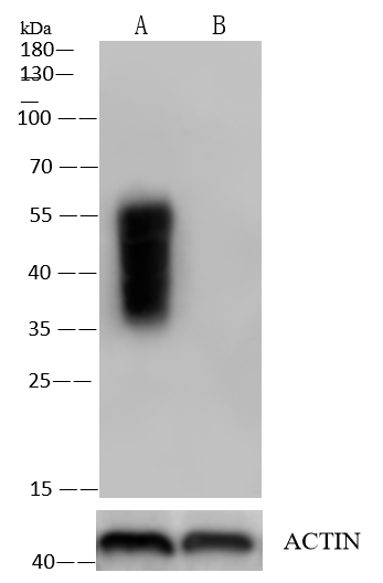 EMMPRIN/CD147 Antibody (125)