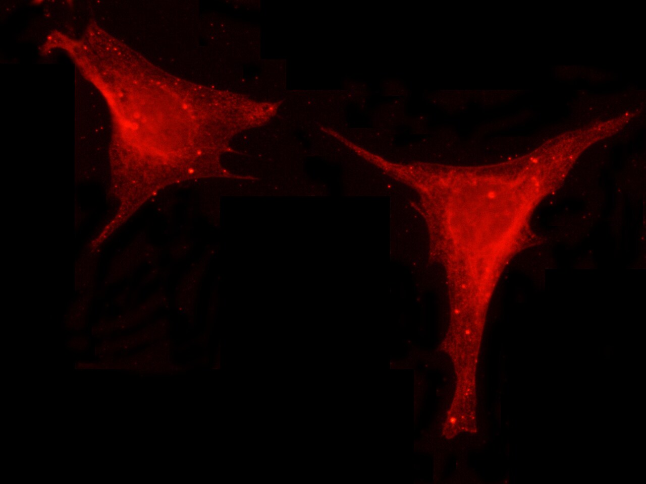 Leptin/OB Antibody (002) - Azide and BSA Free