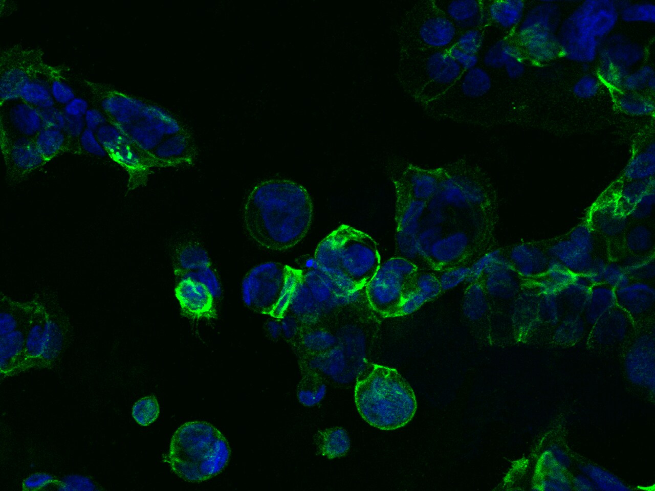 TROP-2 Antibody (001)