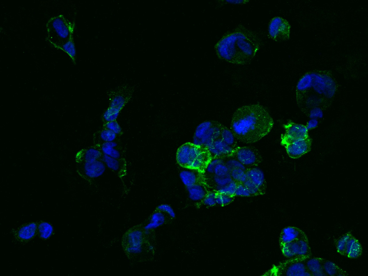 TROP-2 Antibody (020)