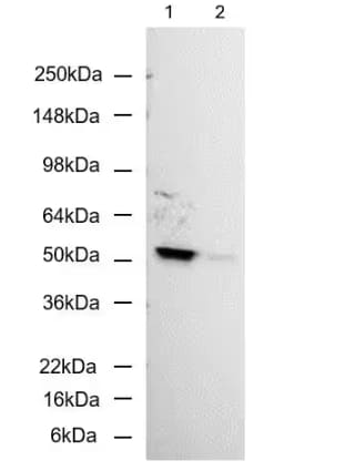Carbonic Anhydrase XIV/CA14 Antibody (515)